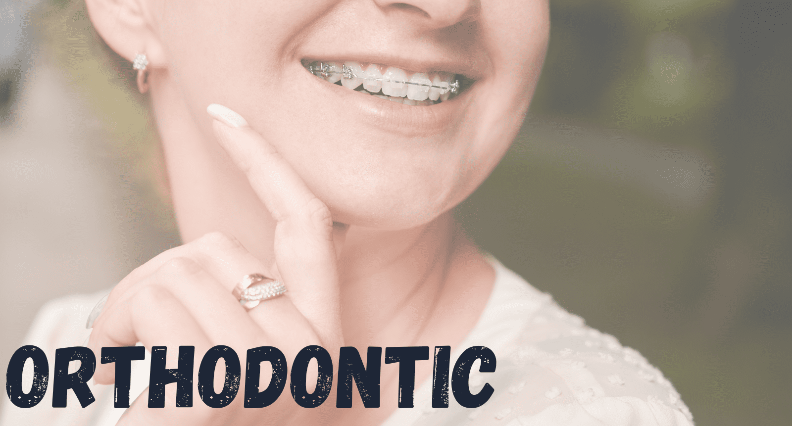 Orthodontics in Chelsea